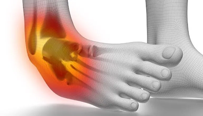 3 Good Tips to Avoid Ankle Injuries